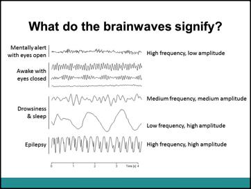2. The EEG records activity in the form of waves. What do the brainwaves signify? Use this slide to discuss how the EEG varies given our state of consciousness.