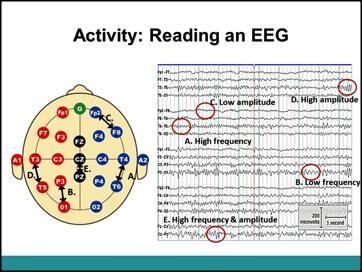 The activity worksheet is included in the Materials Folder for this lesson. 2. Explain to the students we don t really know how this translates into brain function i.e. none of the waves is equivalent to anything like a thought or a memory, they re just showing overall activity in those areas.