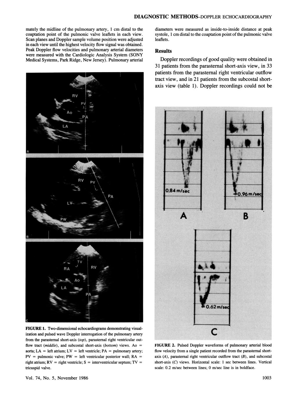 DIAGNOSTIC METHODS-DOPPLER ECHOCARDIOGRAPHY mately the midline of the pulmonary artery, 1 cm distal to the coaptation point of the pulmonic valve leaflets in each view.