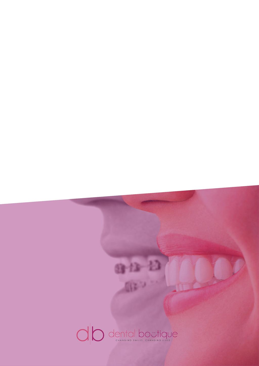 Your guide to Invisalign How misaligned teeth affect