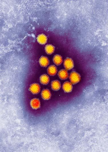 What is rotavirus?