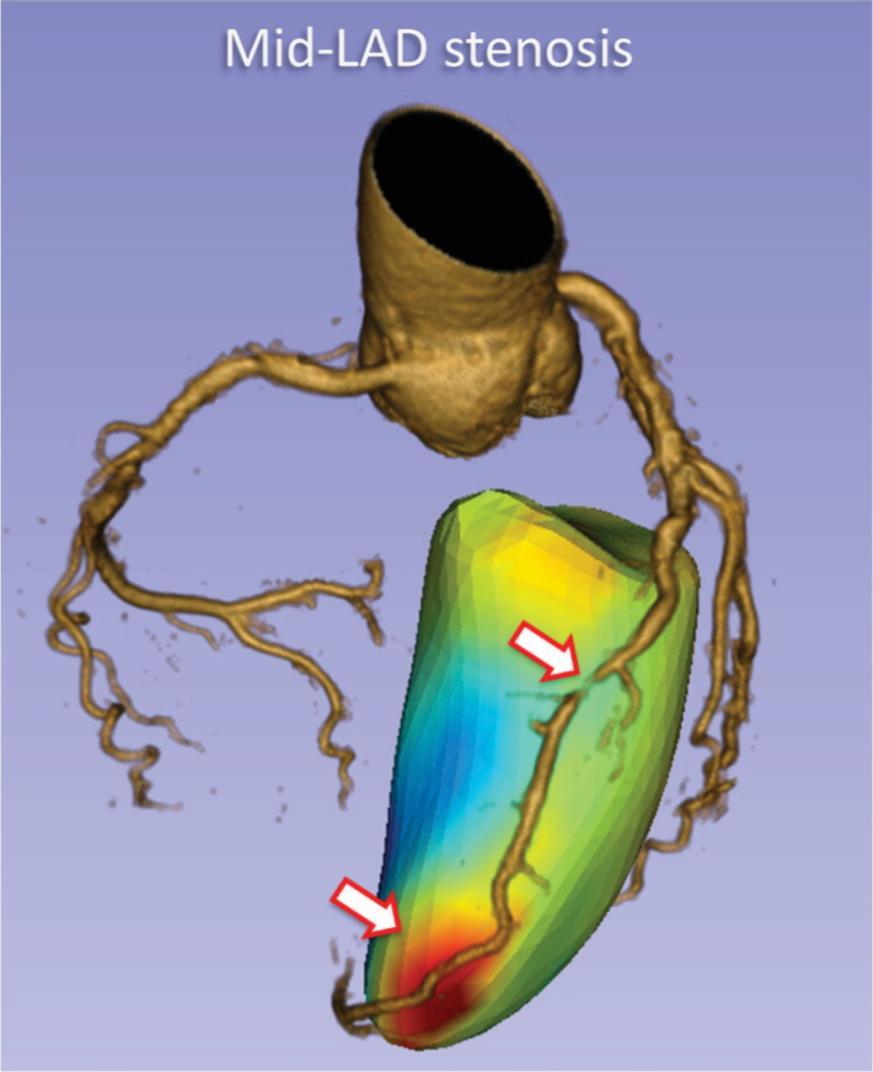 Future - Fusion FUSION IMAGING OF COMPUTED TOMOGRAPHY