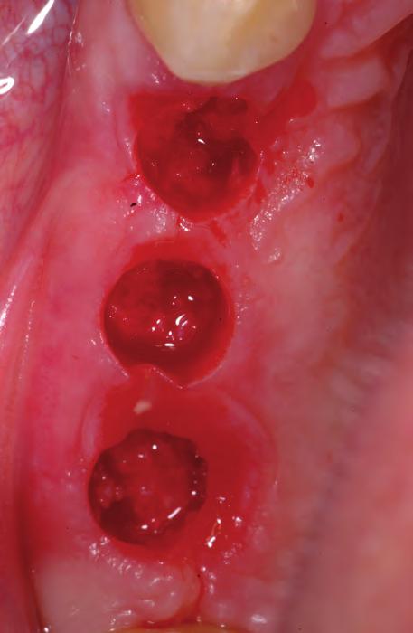 The middle part of the section consists of soft tissue, a combination of mostly yellow bone marrow with small islands of red marrow (hematoxylin-eosin staining).