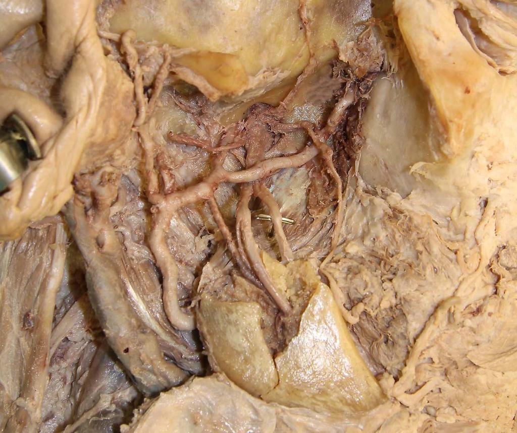 Auriculotemporal nerve Middle