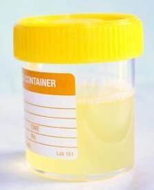 Tests for Incontinence Blood tests kidney function, calcium, glucose Basic urine test Urine culture if needed
