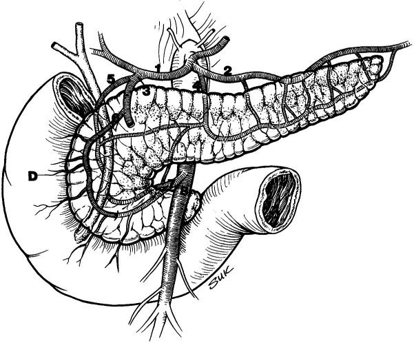 596 12. Pathways of Regional Spread in Pancreatic Cancer Fig. 12 1. Illustration of the arterial anatomy of the pancreas.