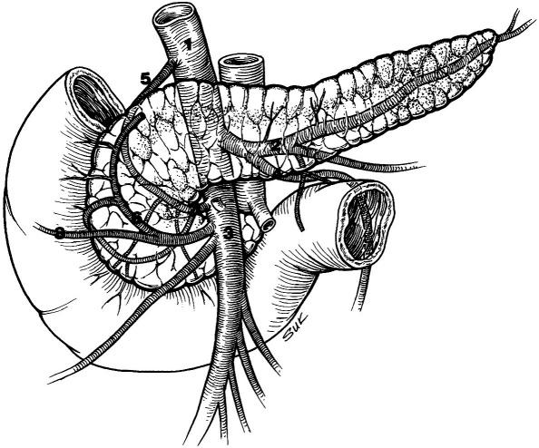 Anatomy of the Pancreas 597 Fig. 12 2. Illustration of the venous anatomy of the pancreas.