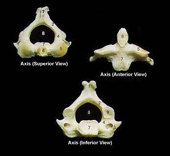 The Axial Skeleton The Cervical Vertebrae The C2 vertebrae is called the Axis The atlas and axis differ from all other vertebrae
