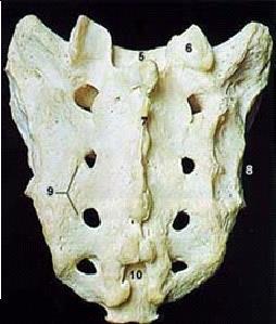 The sacral vertebrae are normally fused together to form the