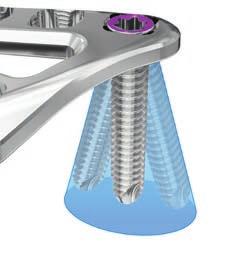 designed to sit flush within the plate* to reduce the likelihood of screw prominence creating a low profile construct