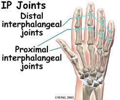 Interphalangeal (IP) Joints Synovial Modified ovoid Hinge joints 1 degree of freedom Flex/ext 2 nd degree