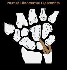 Wrist Ligaments (highlights) Palmar radiocarpal ligaments Resist extension/palmar glide of carpals To scaphoid, capitate,