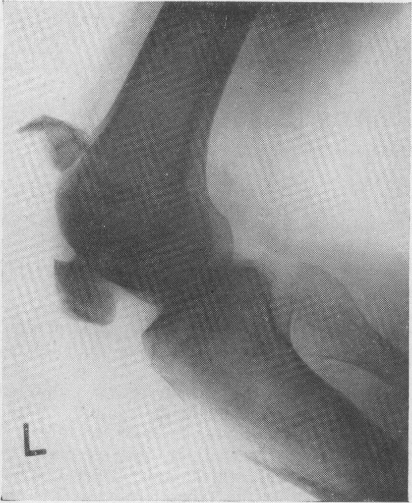 532 L SWEETNAM: (a) FIo. 1.-(a) Widely separated the patella.