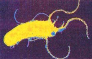 Helicobacter pylori bacterium - a