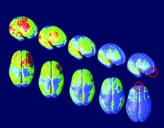 The adolescent brain is different from the adult brain, making it more vulnerable Ages