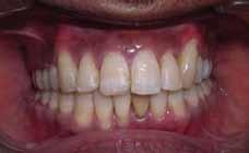American Journal of Orthodontics and Dentofacial Orthopedics 126:140-152 3.