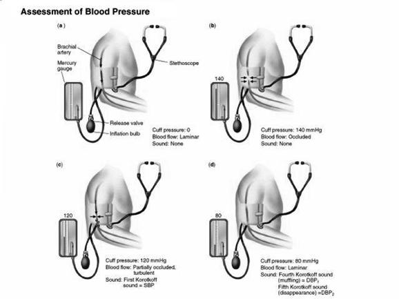 Factors Determining Arterial Pressure Normal values Ø Stroke volume ---- Ps Ø Heart rate ---- Pd Ø Total peripheral resistance (Ps) Ø