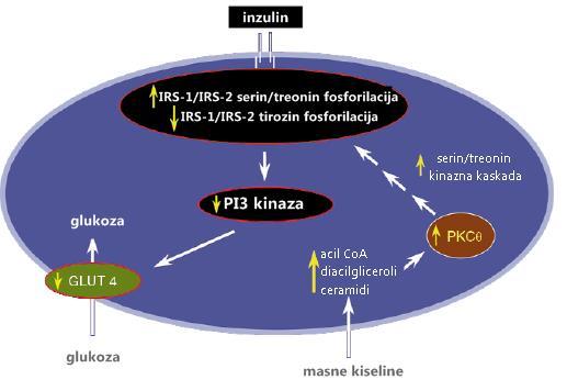 Pretpostavljen je mehanizam kojim bi masne kiseline inducirale nastanak inzulinske rezistencije u mišićima.