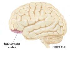 the brain: cerebrum Motor association area in