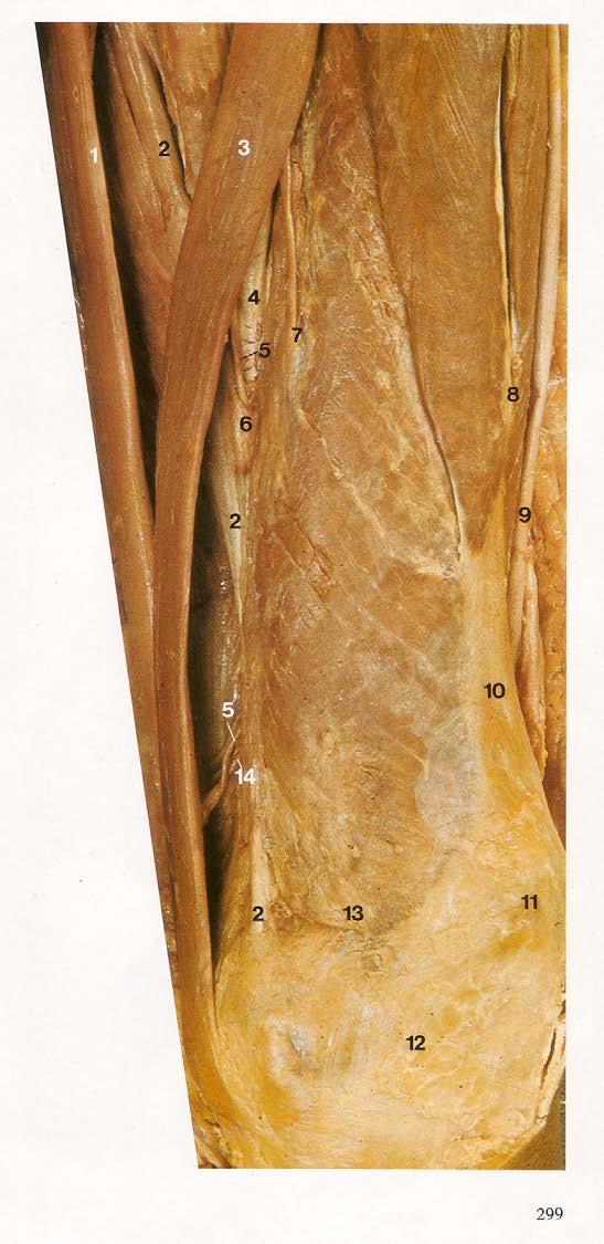 L thigh anterior & medial Adductor Gracilis