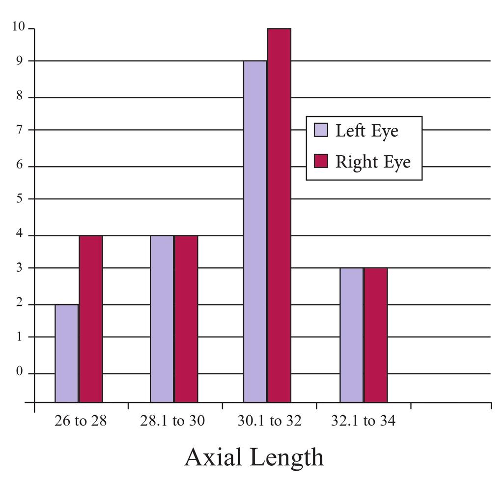 Clear Lens Extraction Abolhasani et al. Figure 1: Distribution of axial length (mm); Mean: OD = 31.01, OS = 30.21; Standard deviation: OD = 2.14, OS = 1.65; N: OD = 21, OS = 19.