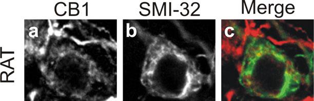 Supplementary Figure 2: Weak somatic CB1 expression in some cortical glutamatergic neurons a-b: Double immunofluorescence confocal micrographs of a