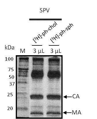 Irudia), gp41 proteinak, aztergai diren lipidoekin elkar eragiten duela ikusten da.