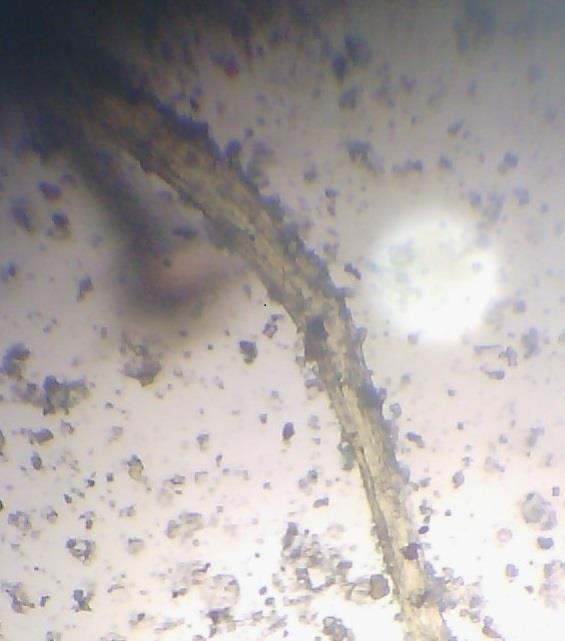 2: Larva of Strongyloides stercoralis Photo 3: