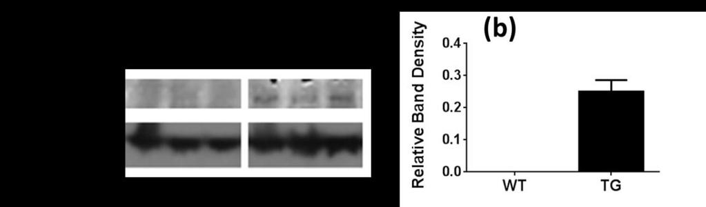 Detection of DUOX1 in TG and WT Rat Brains Fig 5: (a)