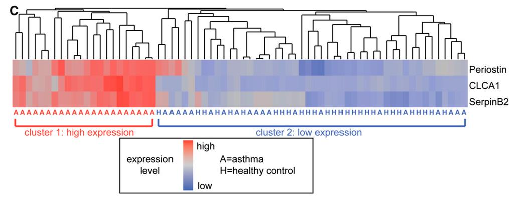 Gene expression microarray Heatmap depicting unsupervised hierarchical clustering of POSTN (periostin), ClCA1 (chloride channel regulator), and SERPINB2 (serpin peptidase inhibitor, clade) following