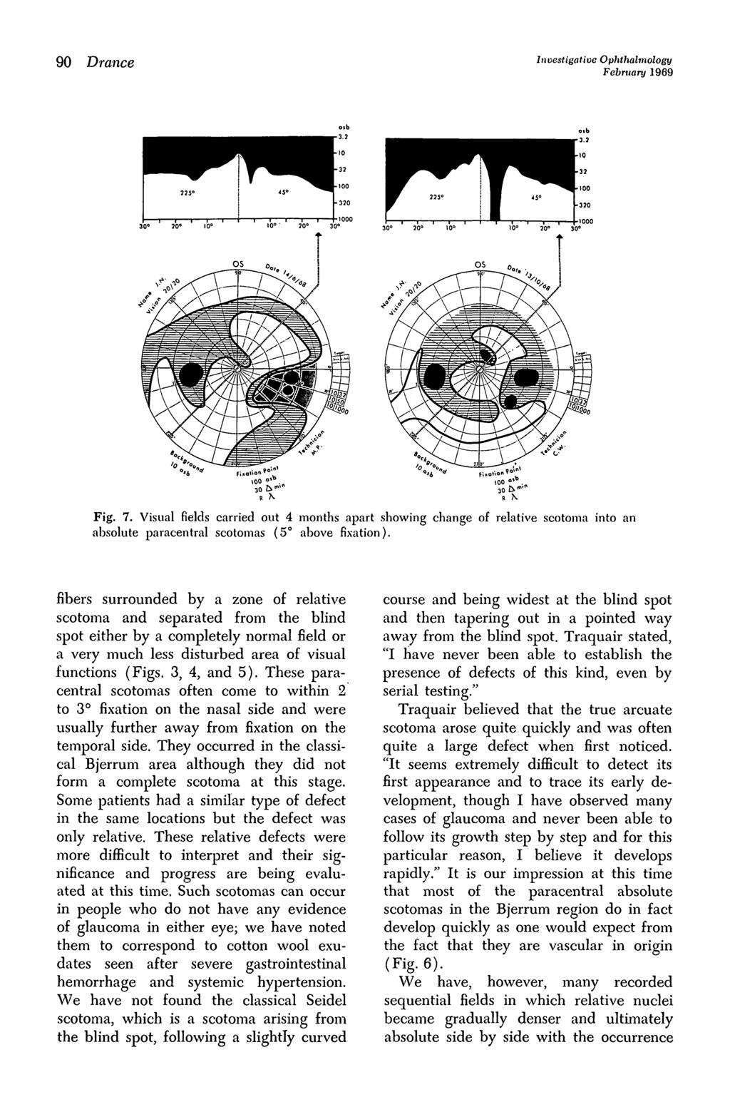 90 Drance Investigative Ophthalmology February 1969 Fig. 7. Visual fields carried out 4 months apart showing change of relative scotoma into an absolute paracentral scotomas (5 above fixation).