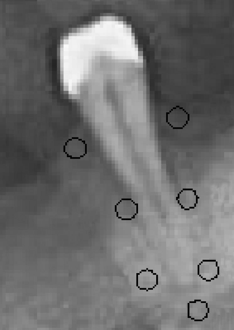 ROI 2 1 mm distalno od parodontnog ligamenta po vrhu alveolarnog grebena ROI 3 1 mm mezijalno od parodontnog ligamenta u razini apeksa korijena zuba ROI 4 1 mm distalno od parodontnog ligamenta u