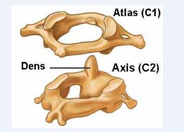 Osseous Anatomy C1 and C2 Vertebra Are Atypical C1 (atlas): 2 lateral masses connected by a short anterior and a longer posterior arch NO vertebral body Lateral masses form the inferior portion of