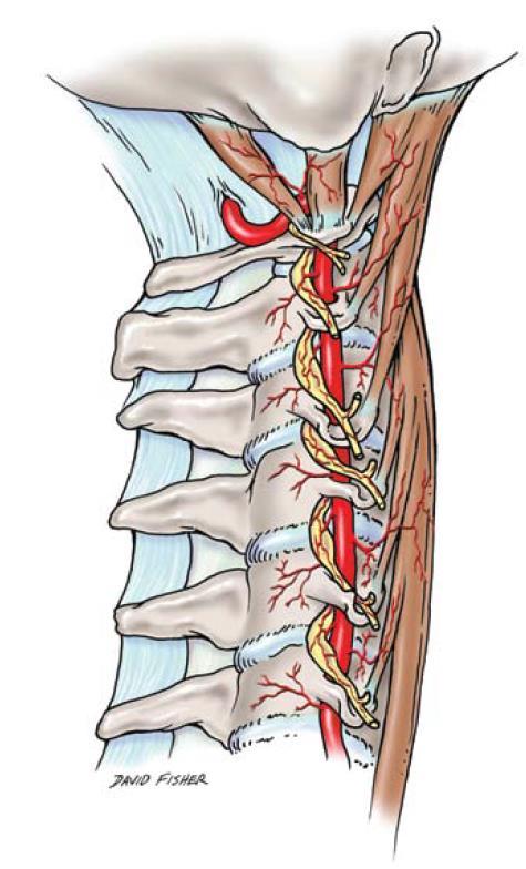The Vertebral Artery The V2 segment of the vertebral artery lies anterior to the lateral masses at C2-7 The vertebral artery in the V3 segment passes