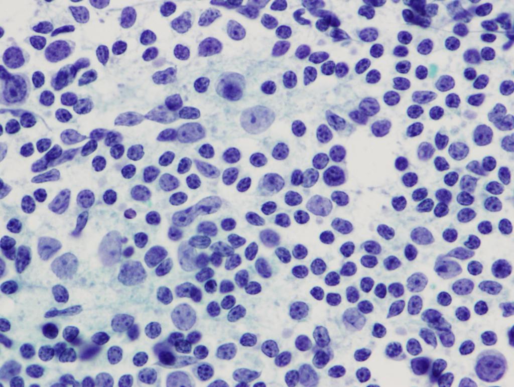 Lymph Node Cell Population Dendritic reticulum cells