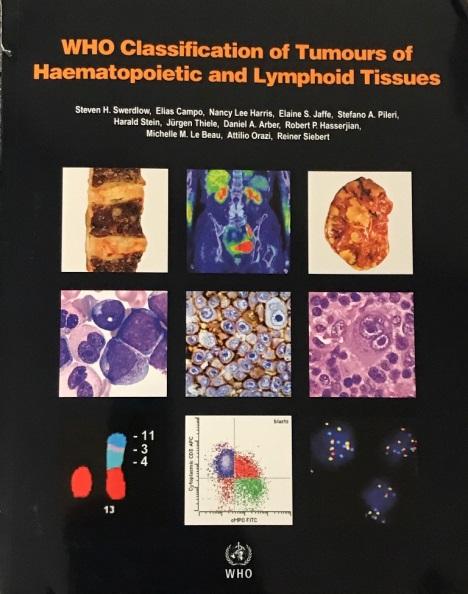 2017 WHO Classification of Haematopoietic and Lymphoid Tissues 17 new entities Mature B-cell NHL: 23 36 T-cell NHL