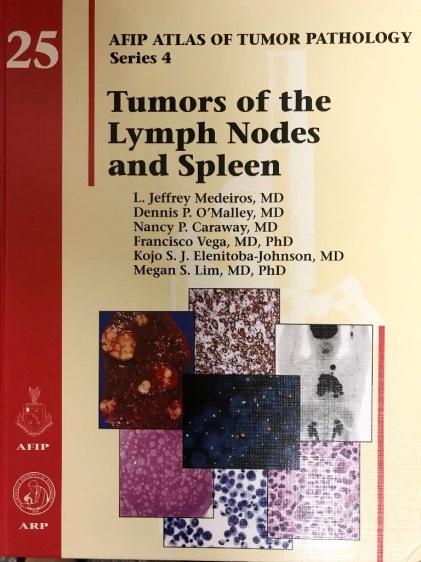 Small Needle Bxs in Dx Lymphomas Assess lymphadenopathy Primary diagnosis of lymphoma Diagnose recurrence of lymphoma Assess for transformation to higher grade lymphoma Diagnose secondary neoplasms