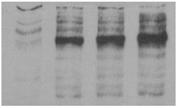Supplementary Figure 2 Ub Ub Ub H159 Jurkat K562 0 30 90 180 min 0 30 90 180 min Ub Ub Ub SKOV3.ip1 A375 Ishikawa Ub HEC1B increases the abundance of ubiquitinated in many cancer cells.