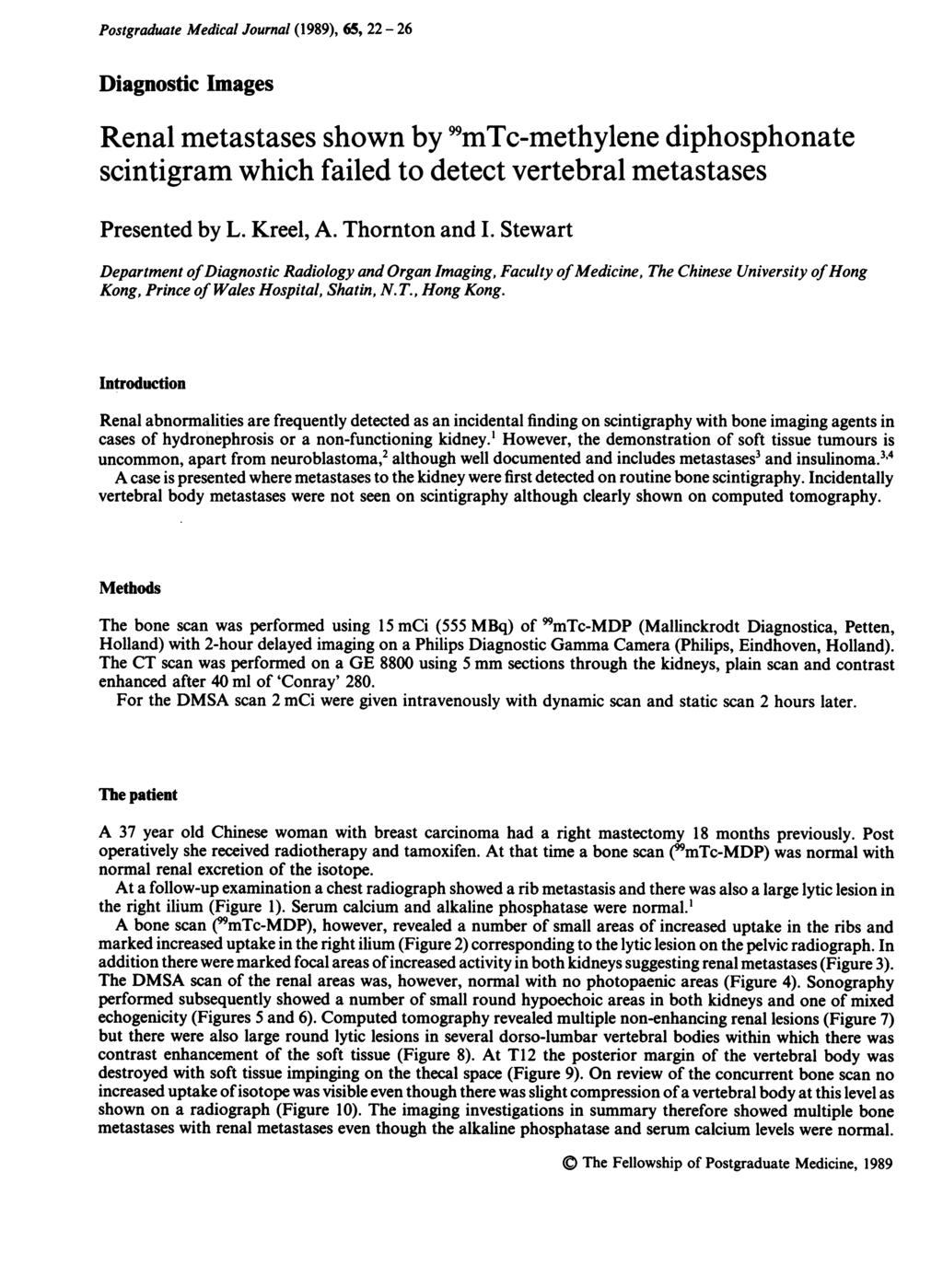 Postgraduate Medical Journal (1989), 65, 22-26 Diagnostic Images Renal metastases shown by 9mTc-methylene diphosphonate scintigram which failed to detect vertebral metastases Presented by L. Kreel, A.