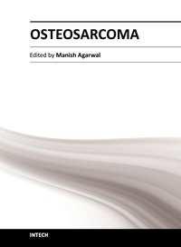 Osteosarcoma Edited by Dr.
