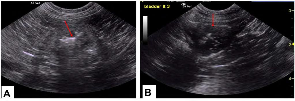 Ultrasound-Guided Flushing of the SUB (Figure 2,3): should be done through the shunting port using a Huber needle (Figure 1b,c; Figure 2).