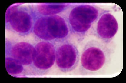basophilic Hepatoid cell Abundant pale blue