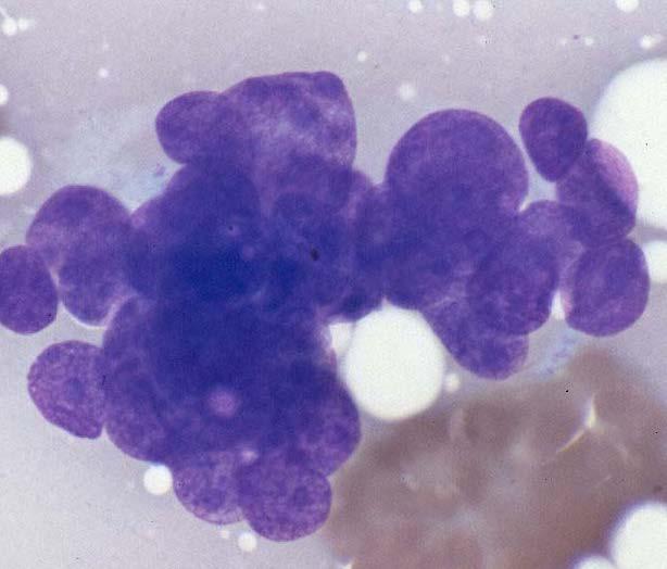 cytoplasm Basal cell
