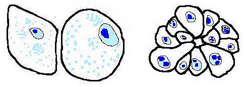 3 basic tumor cell types Epithelial Size