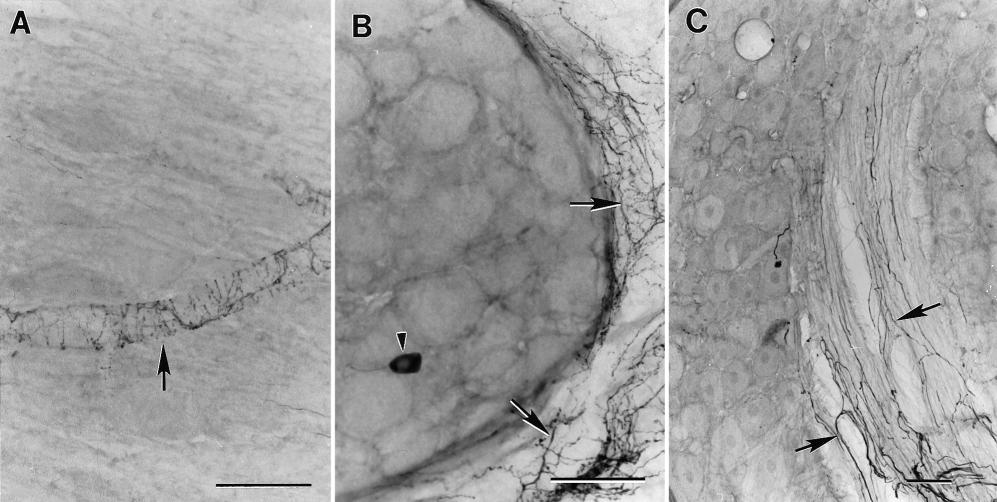 H. J. W. Nauta, et al. FIG. 1. Photomicrographs showing TH-immunostained lumbar DRGs of rats that received ACSF infusion.