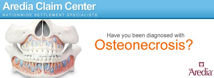 Osteonecrosis of the jaw (ONJ) What is ONJ?