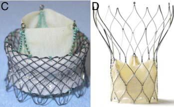 TAVR- The Future New TAVR systems