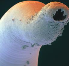 Adult female worms migrate to the anal margin to deposit eggs, giving the characteristic symptom of nocturnal perianal itch.