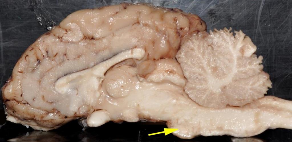 Nsci 2100 Midterm Exam 1 page 7 39. What structure is indicated by the yellow arrow in the photograph of a sheep brain below? A. medulla B. cerebellar vermis C. cerebral aqueduct D.