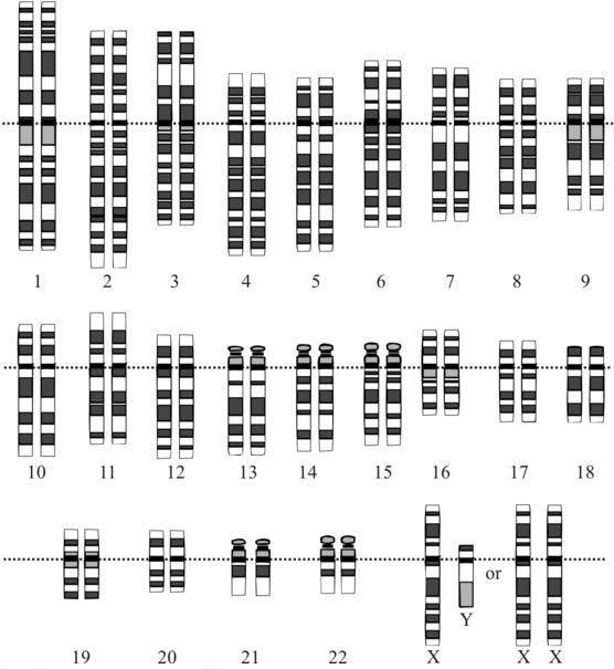 Chromosome Analysis (Karyotype) What is it good for?